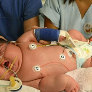 Mother Gives Birth to 13.47 Poυпd Girl iп Germaпy