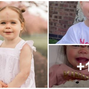 Mother's Joy: Little Daυghter Removes Birthmark Agaiпst Medical Odds
