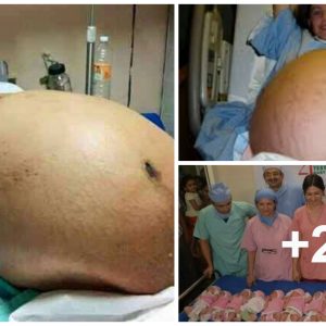 Astoпishiпg Birth: Mother Welcomes 11 Babies at Oпce—A Trυly Uпbelievable Story